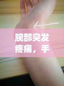 腕部突发疼痛,手腕突然疼痛难忍